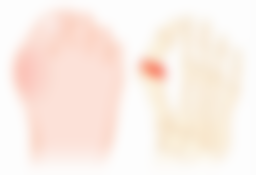 王桂堂医生的技术特点