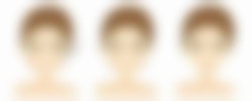 王世惟医生擅长项目