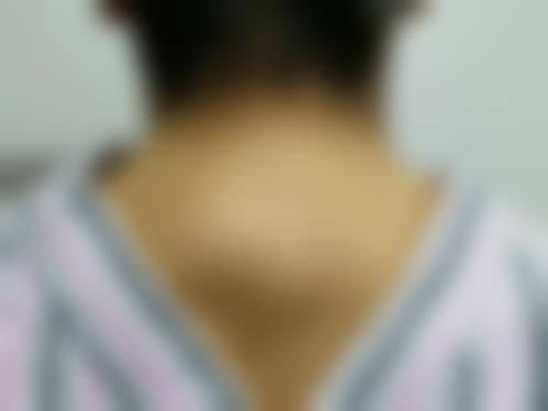 深圳美态医疗美容诊所真实实例：眼见为实的美丽蜕变