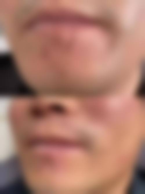 宁德市闽东医院烧伤整形外科价格表