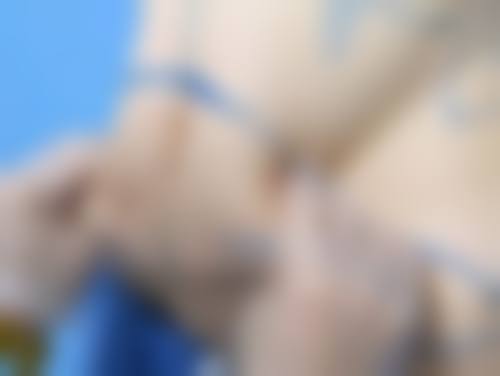 潘会章医生真实实例