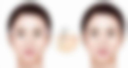 腰部吸脂减少脂肪堆积的成效好不好？