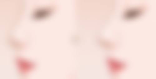 腰部吸脂瘦腰塑形的成效靠谱吗？