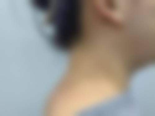 广州白云山医院整形科价格表