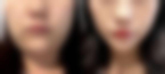 潘会章医生怎么预约挂号