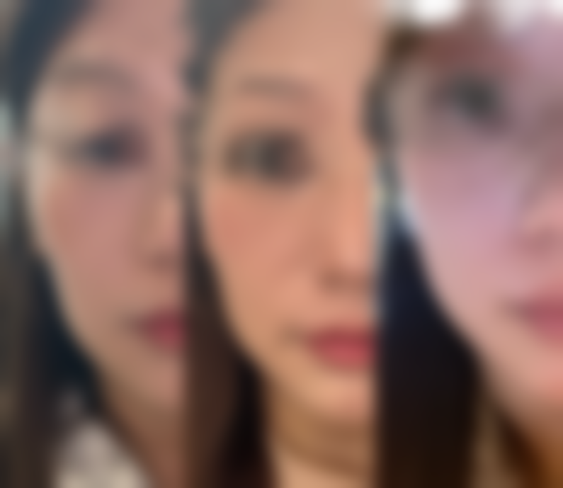 厦门美丽薇整形美容医院擅长项目