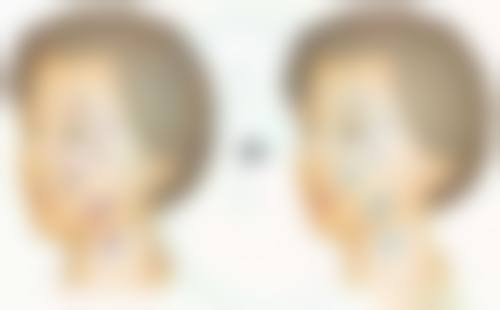 于永峰医生擅长项目