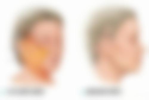 李雅江医生擅长项目