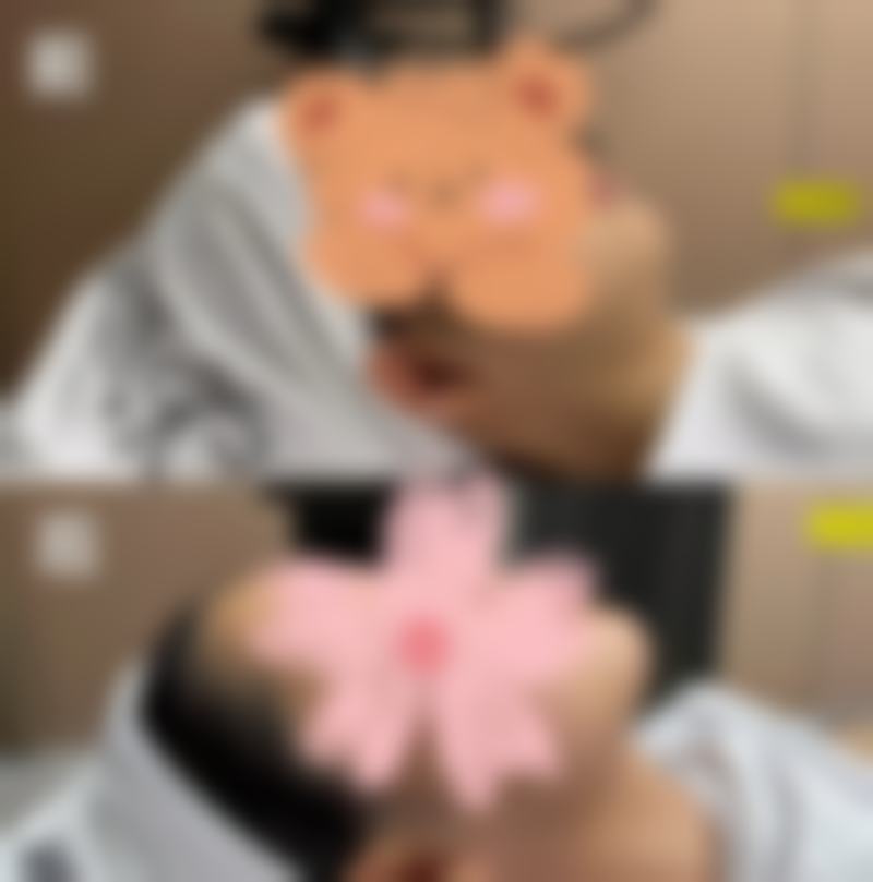 杭州瑞丽整形外科门诊部(玉古路)真实实例