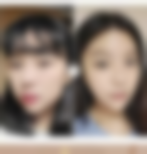 拉双眼皮多久能好，美莱医美医院怎么样？