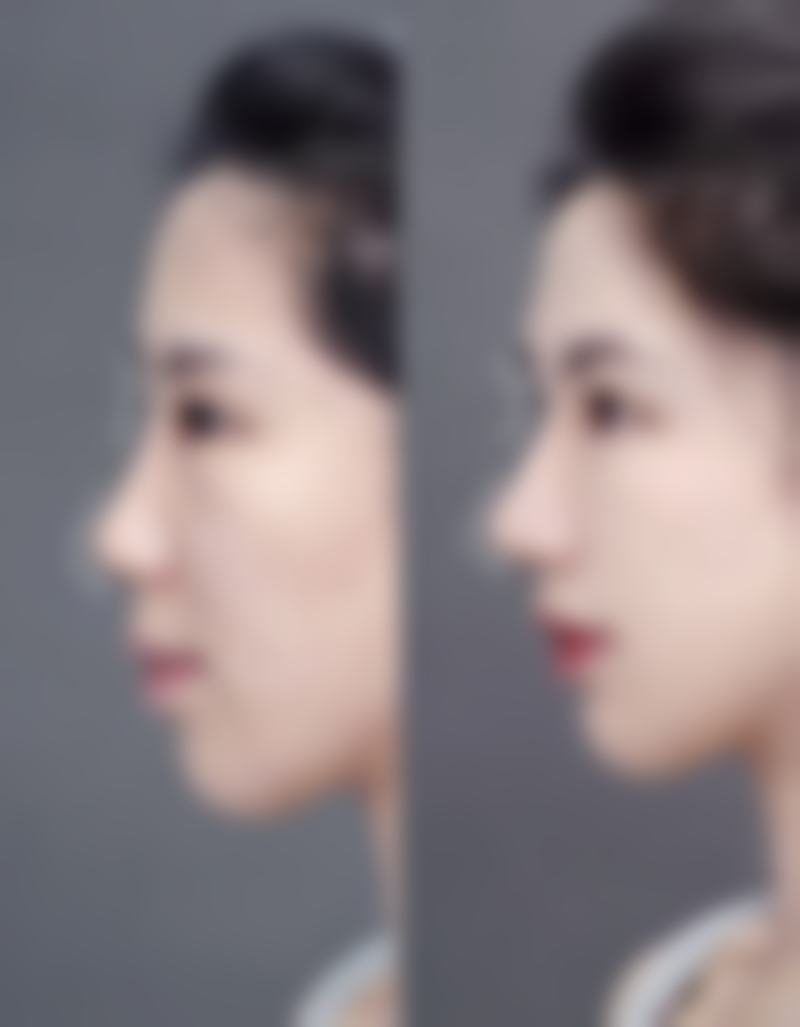 广州美恩整形美容电话号码:一键开启变得更美询问