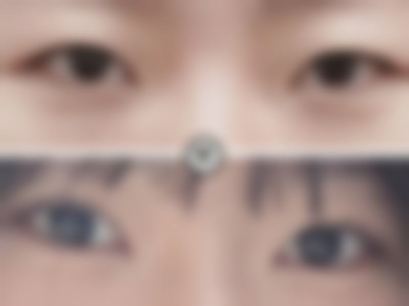 马雪鸣医生技术特点