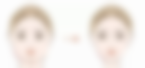 郭永信医生看诊优势