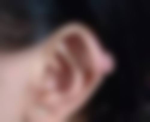 割双眼皮手术适合所有人吗