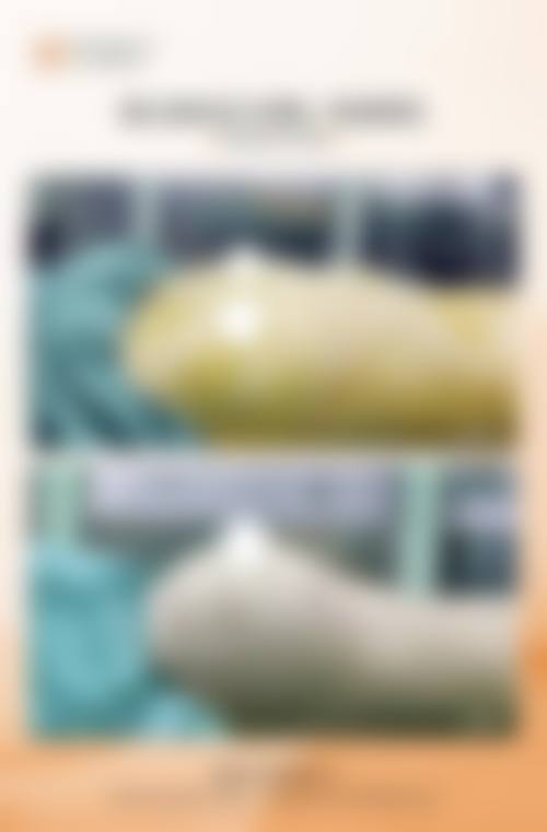 郑州爱都沪美人医疗美容门诊部真实实例