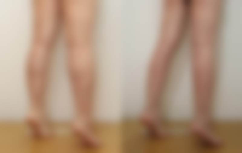 韩国sage医院李敬秀做隆鼻手术成效好吗