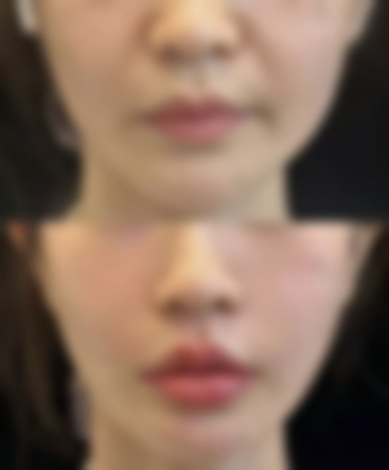 骨科刘通医生专精擅长