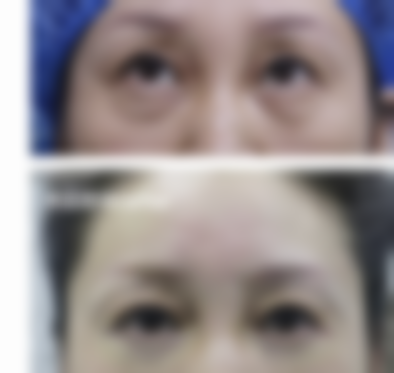 骨科刘通医生座右铭