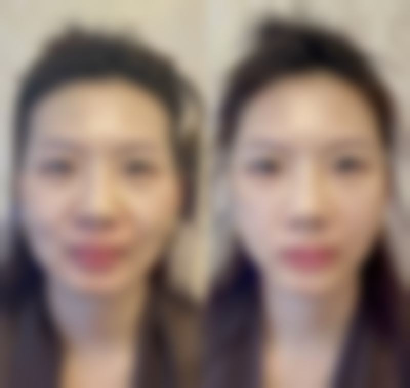 医美刘通医生怎么预约挂号