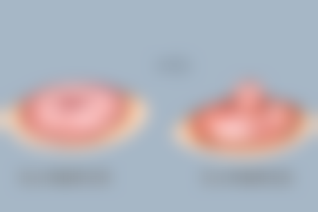 卢忠询医生真实实例