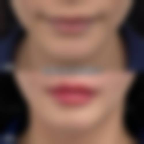 长沙致美医疗美容门诊部价格表