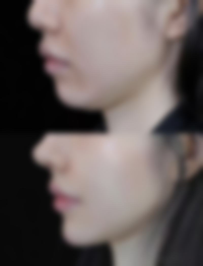 曙光医美医院做双眼皮手术修复时间合理吗