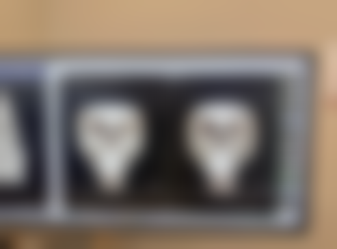 做双眼皮手术需要多久时间恢复？一般7 - 15天消肿，1 - 3个月基本恢复自然，6个月到1年完全恢复！ 