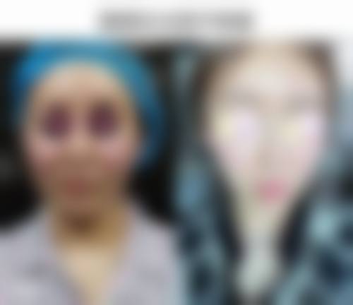 吉林大学第二医院民康医院价格表