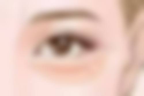 黑眼圈眼袋大通过激光治疗靠谱吗