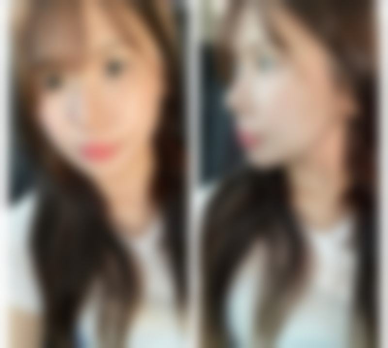 汉中3201医院医学整形美容科擅长项目