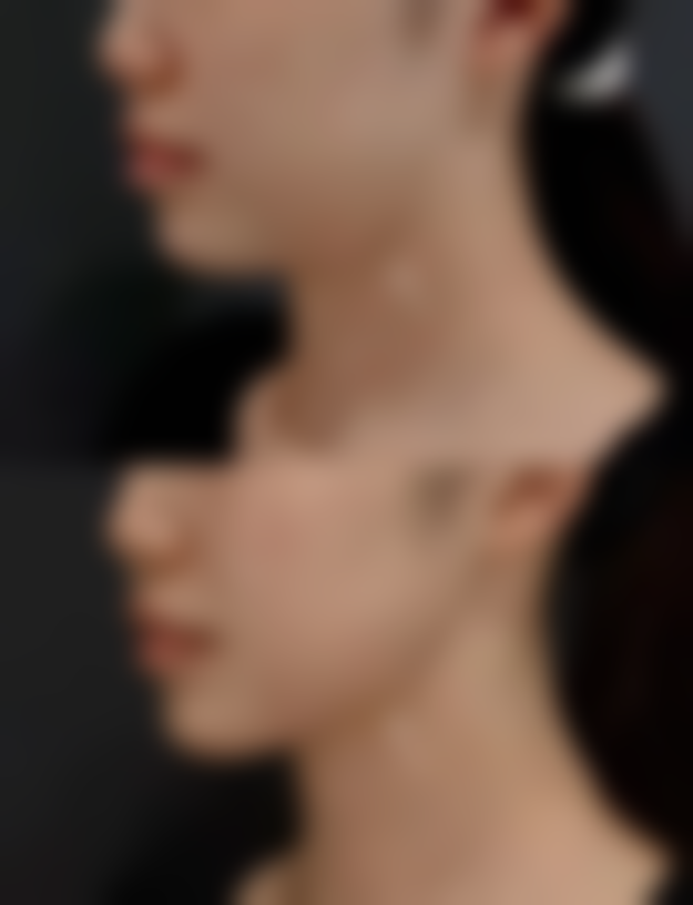 日常护理能有效去除眼袋吗，有哪些方法？