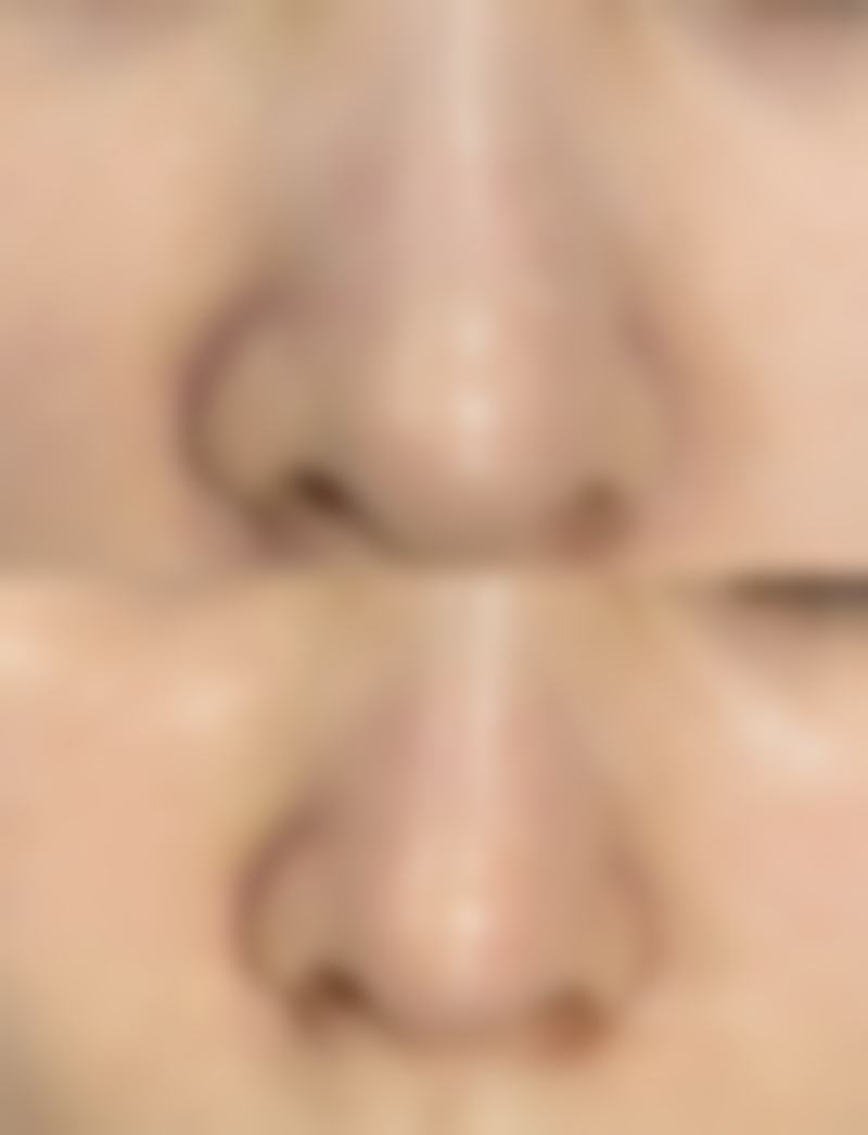 脸部疤痕美容在美莱医美医院靠谱吗