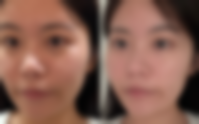 武汉颜鉴医疗美容门诊部擅长项目