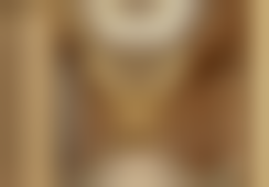 江苏省李辉的双眼皮手术收费3800元靠谱吗?