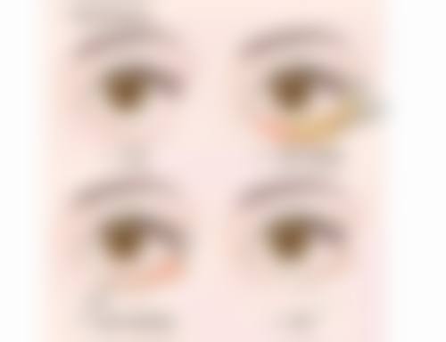 徐斌荣医生技术特点