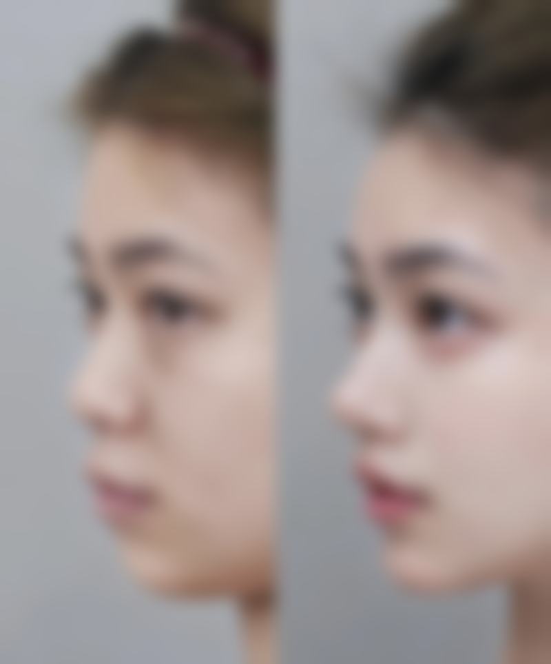 天津莉菲儿医疗美容诊所价格表:合理收费性价比高