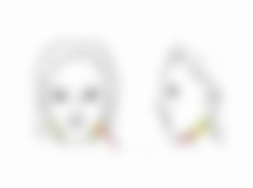 脸部吸脂肿胀期后成效怎么样