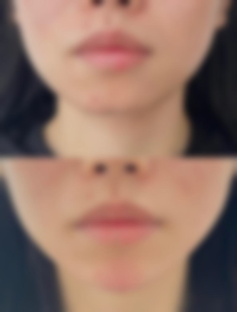 卢忠询医生坐诊医院