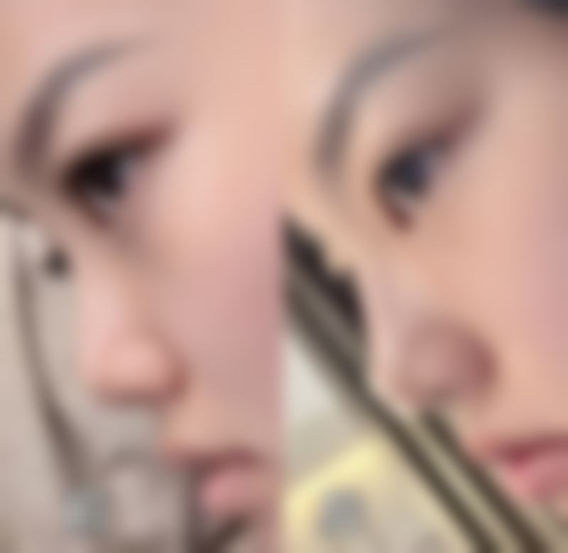 福清天宝美容医院仪器设备：精良科技助力变得更美