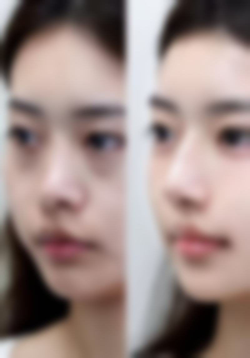 南京瑞淇出色医疗美容诊所擅长项目