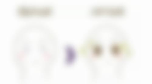 耳软骨隆鼻易吸收变形的情况怎么样