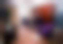 北京米兰柏羽丽都医疗美容医院杨斌做的脂肪填充手术值不值