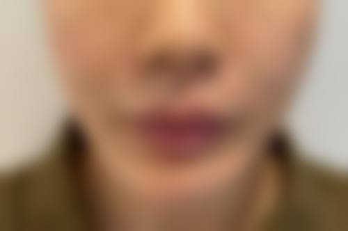 成都青羊瑛爱整形医疗美容门诊部擅长项目