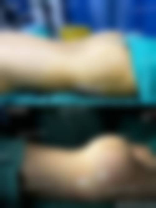 大庆圣熹美医疗美容门诊价格表