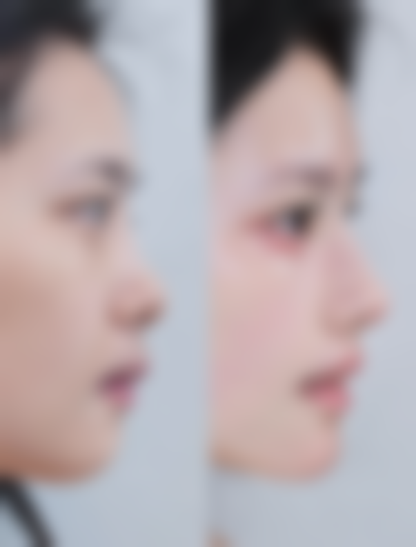 成都青羊瑛爱整形医疗美容门诊部价格表