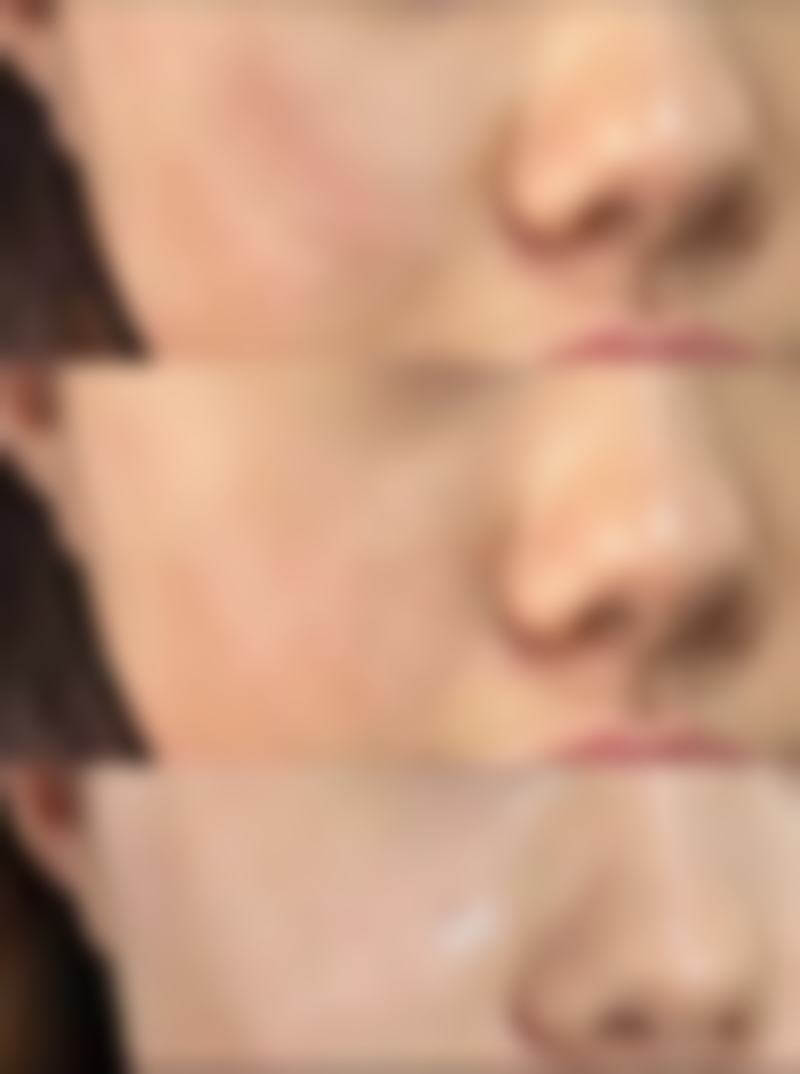 美白精华液改善疤痕色素沉着成效怎么样