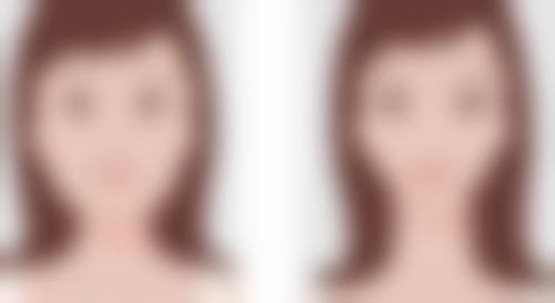 做阴道紧缩术后能顺产吗？权威解析：多数情况有风险，需术前评估，术后遵医可降低不利影响！ 