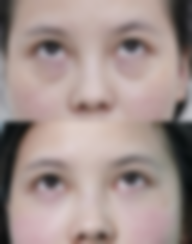 成都美熹国内外医疗美容真实实例