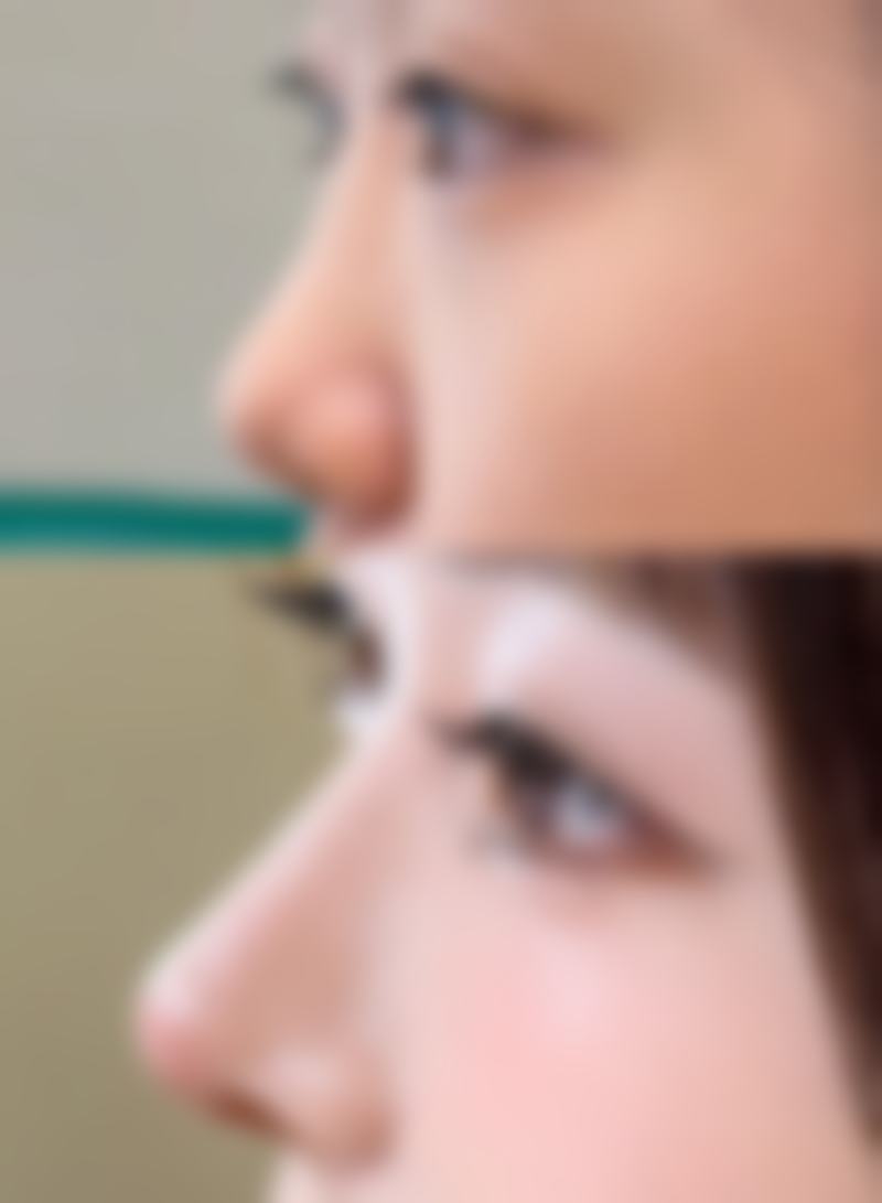 秦皇岛市百惠医疗美容诊所擅长项目