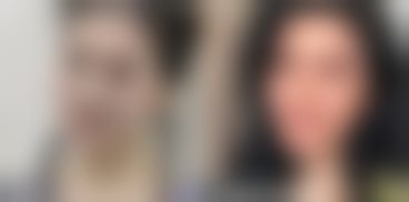 北京碧莲盛医疗美容门诊仪器设备：精良技术助力植发